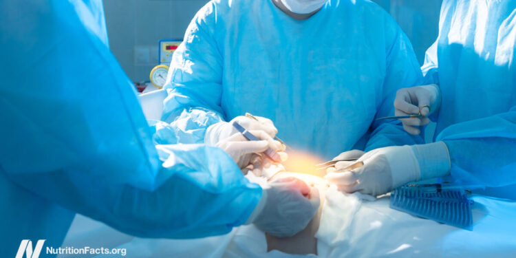 Bariatric Weight-Loss Surgery and Mortality