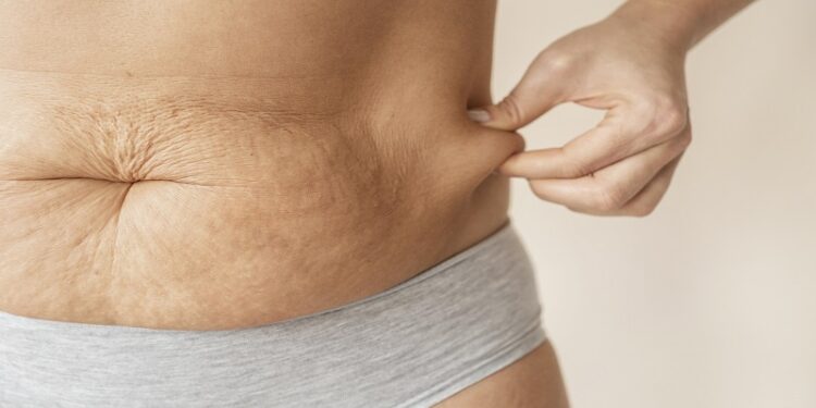 Tips to Tighten & Tone Skin